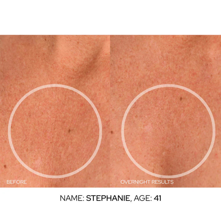 SiO Chestlift