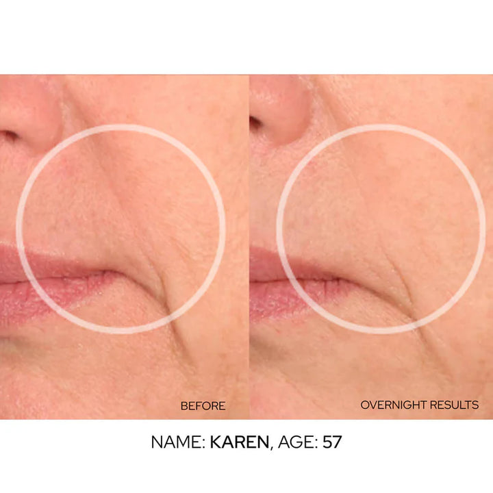 SiO Super LipLift