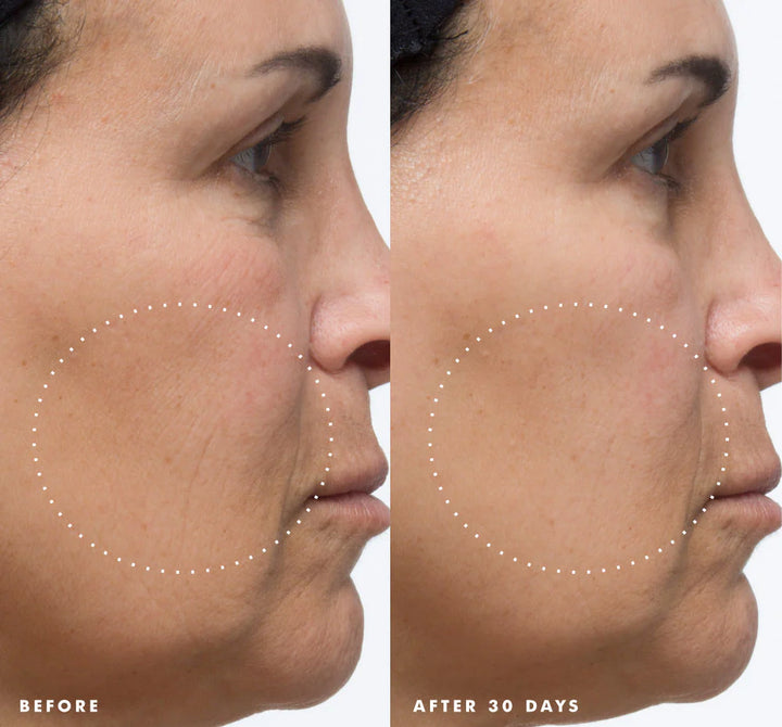 Superdew & Renew Facial Set