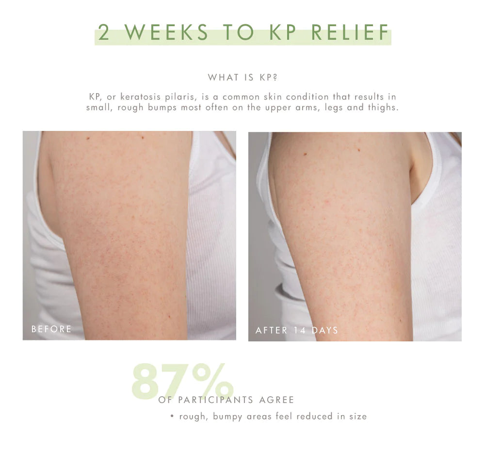 Smooth Reveal: Resurfacing Silky Serum