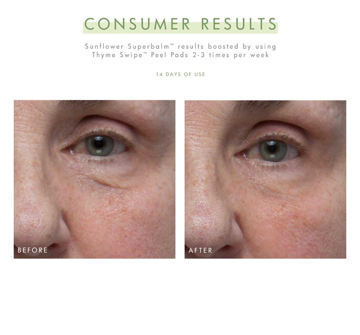 Superdew & Renew Facial Set