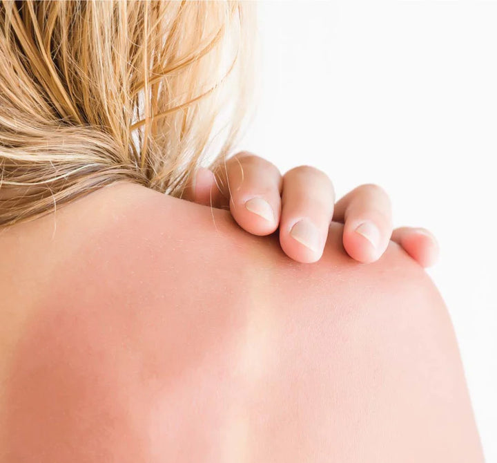 Ahhhsome Relief: Foam-to-Oil After Sun Body Mousse