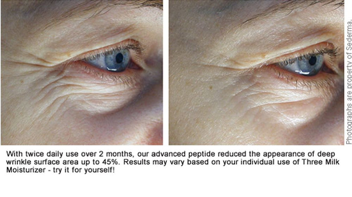 Deep Hydration Facial Set