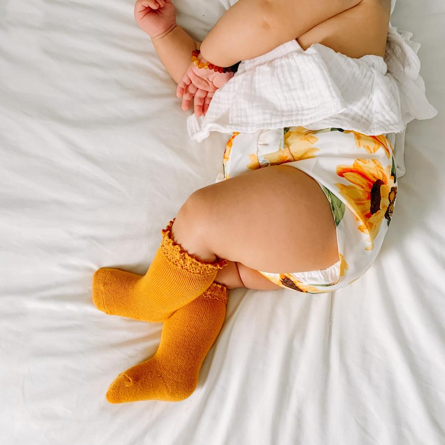 Marigold Yellow Lace Top Knee Highs
